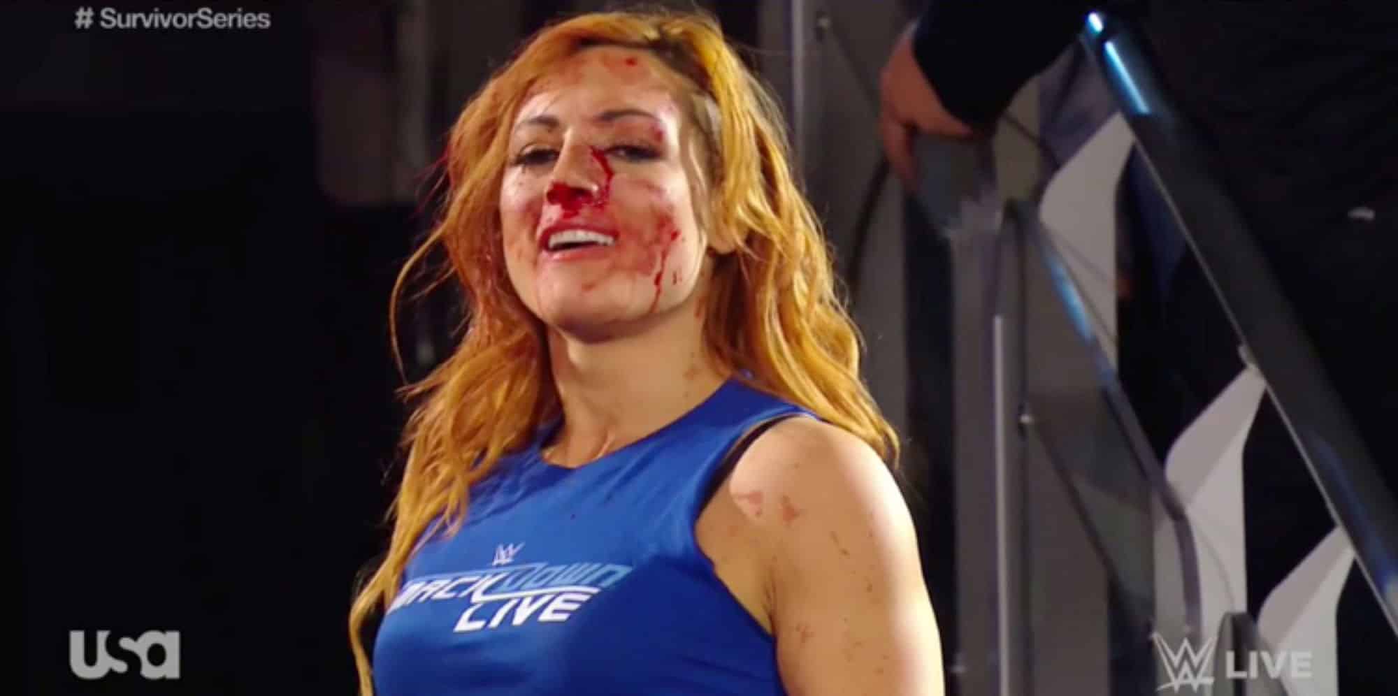 Histórico Becky Lynch