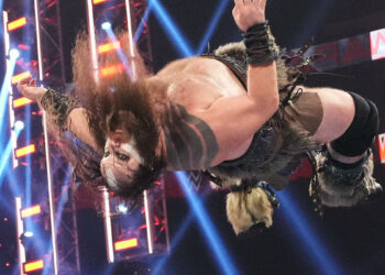 Ivar confirma que sufre de un daño permanente en los nervios de su mano